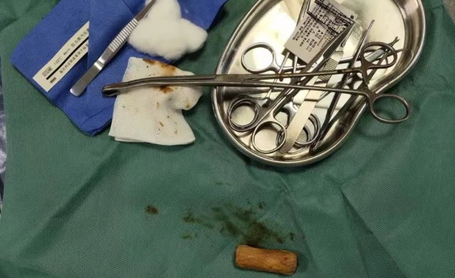 ��W������挢5̖늳����M���T�����ؓp����ϵ�y